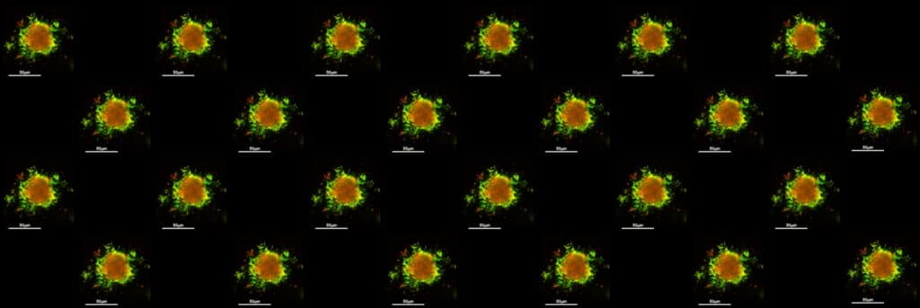 Biofilms & Spatially Organized Communities - B3D